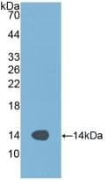 GPT / Alanine Transaminase Antibody (aa367-480)