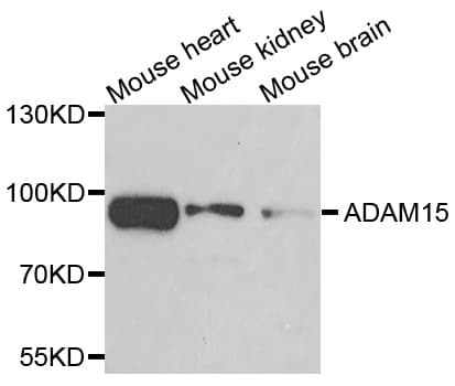 ADAM15 Antibody