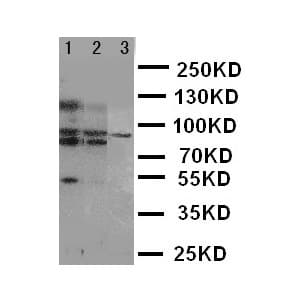Polyclonal Rabbit anti-Human ABCB6 Antibody (aa818-842, IHC, WB)