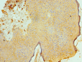 Polyclonal Rabbit anti-Human BAF53B / ACTL6B Antibody (aa1-280, IHC)