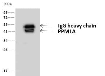 PPM1A / PP2CA Antibody (Preservative Free)