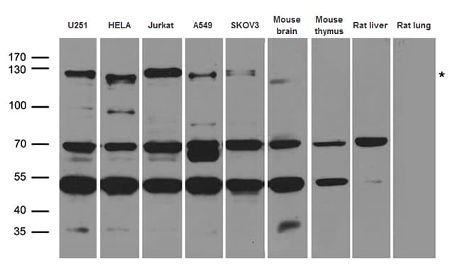 NEDD4 Antibody