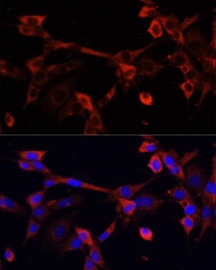 DNASE1L1 Antibody