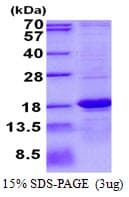 Human ASPRV1 / SASPase Protein (Recombinant His)