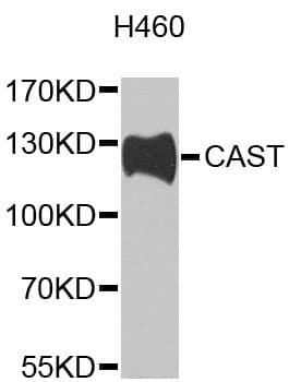 CAST / Calpastatin Antibody