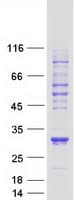 Human VHL / Von Hippel Lindau Protein (Recombinant Myc-DDK (Flag))