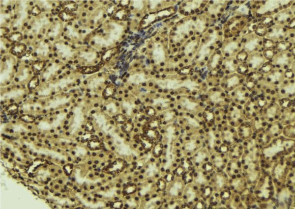 Polyclonal Rabbit anti-Human NOX4 Antibody (IHC, WB)