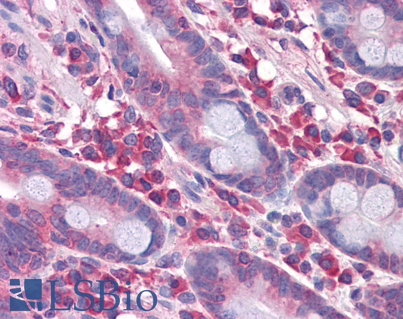 IHC-plus™ Requiem / DPF2 Antibody (clone 2F6)
