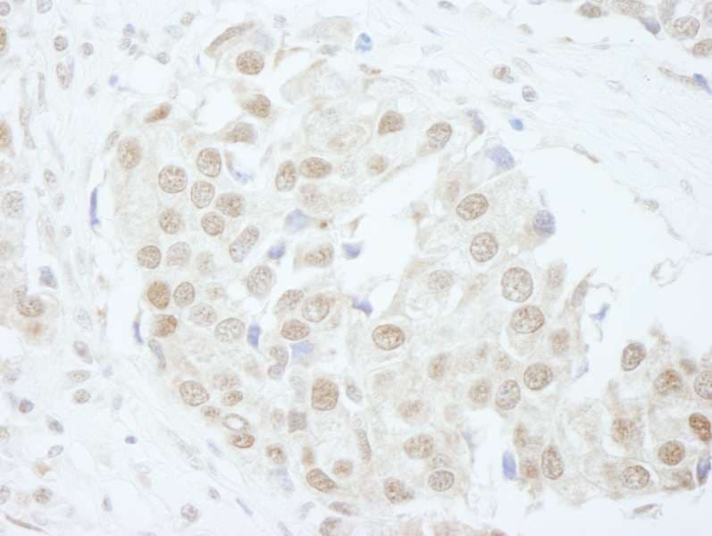 Polyclonal Rabbit anti-Human PUS1 Antibody (aa377-427, IHC)
