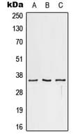 IHC-plus™ CD32C Antibody (C-Terminus)