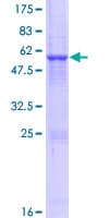 Human ADAL Protein (Recombinant GST)