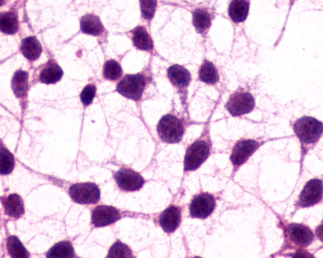 PathPlus™ GRM3 / MGLUR3 Antibody (N-Terminus)