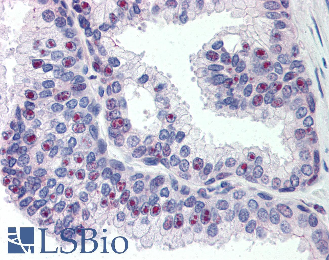IHC-plus™ CHD2 Antibody (aa1595-1611)