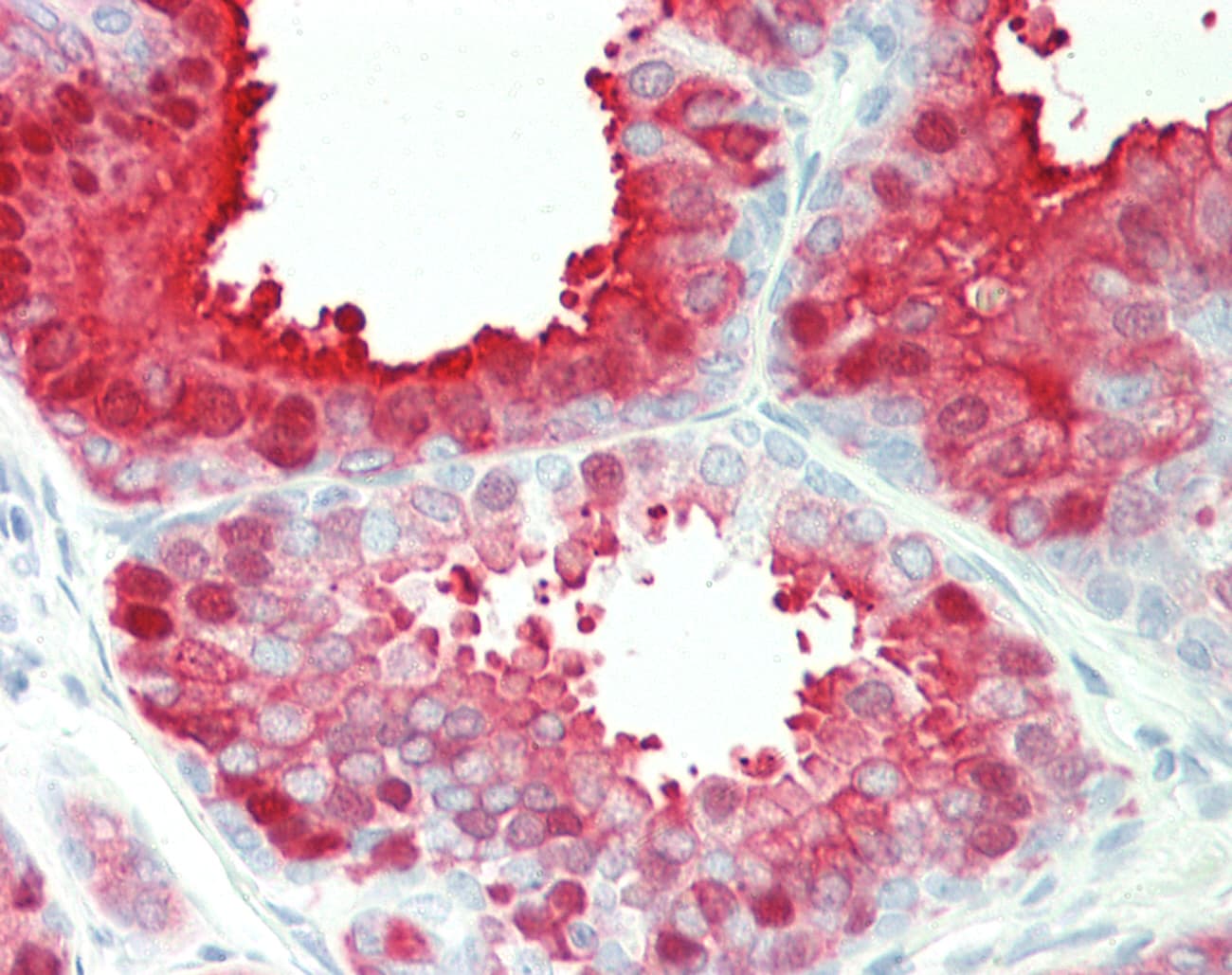 Polyclonal Rabbit anti-Human TGM4 / Transglutaminase 4 Antibody (aa143-192, IHC, WB)