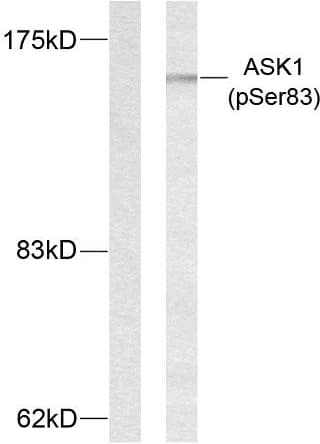 MAP3K5 / ASK1 Antibody (phospho-Ser83)