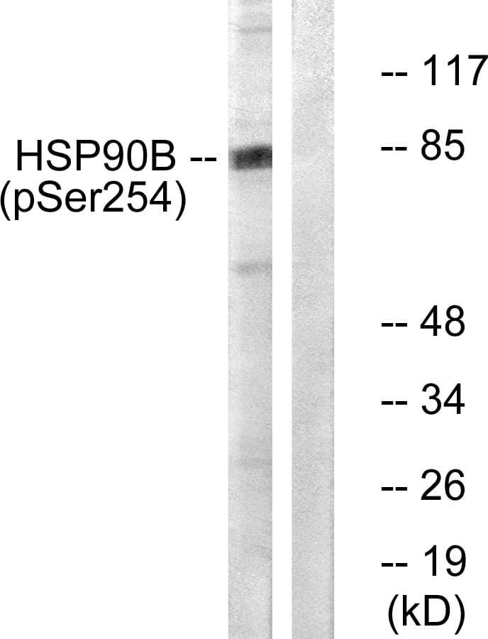 Polyclonal Rabbit anti-Human HSP90 Beta Antibody (phospho-Ser254, IHC, IF, WB)