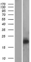 Human NPC2 Protein (Over-Expression Lysate Myc-DDK (Flag))