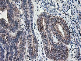 Monoclonal Mouse anti-Human DLD / Diaphorase / E3 Antibody (clone OTI4A10, IHC, IF, WB)