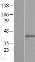 PIH1D2 Protein (Over-Expression Lysate Myc-DDK (Flag))