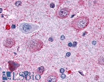 PathPlus™ Polyclonal Rabbit anti-Human OPRD1 / Delta Opioid Receptor Antibody (N-Terminus, IHC)