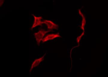 SCN4B Antibody