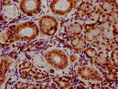 Polyclonal Rabbit anti-Human HIST1H2AI Antibody (IHC)