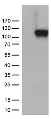 Complement C6 Antibody (aa176-522, clone OTI2G1, Carrier-free)