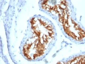 FSCN1 / Fascin Antibody (clone FSCN1/417)