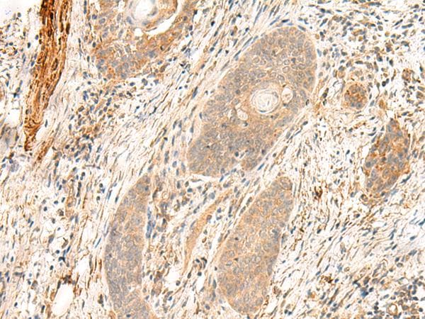 Polyclonal Rabbit anti-Human ABP-280 / FLNC Antibody (IHC, WB)