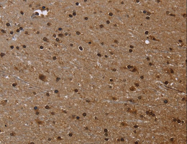 FLNA / Filamin A Antibody