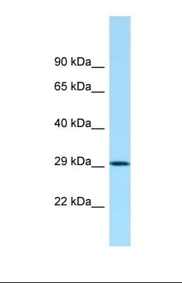 Polyclonal Rabbit anti-Human ACY3 Antibody (aa147-196, WB)
