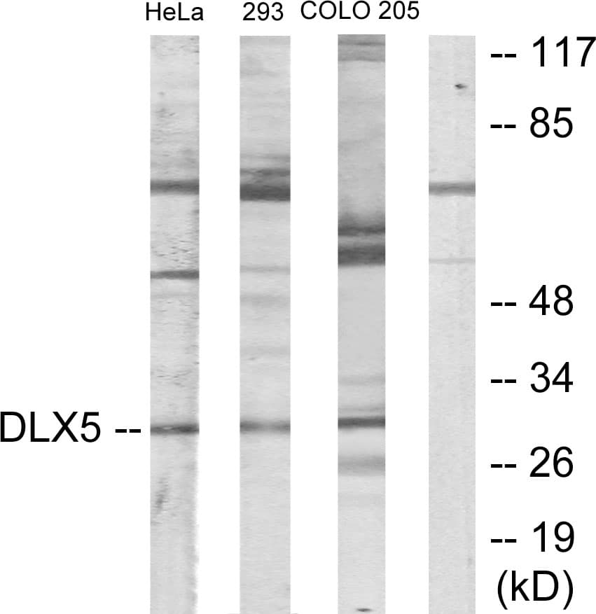 IHC-plus™ DLX5 Antibody (aa91-140)