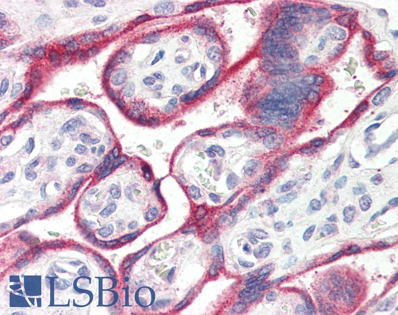 IHC-plus™ Polyclonal Goat anti-Human CYP19 / Aromatase Antibody (aa475-486, IHC, WB)