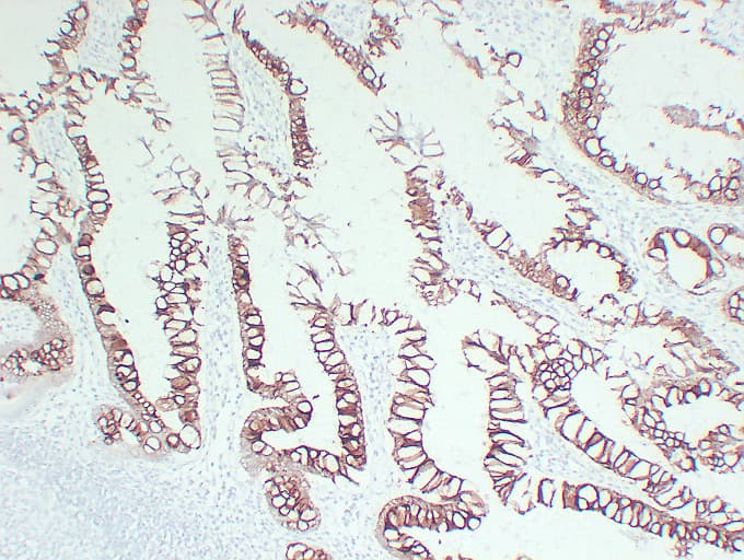 KRT20 / CK20 / Cytokeratin 20 Antibody (clone ABT-Ck20)