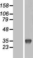 UP / UPP1 Protein (Over-Expression Lysate Myc-DDK (Flag))