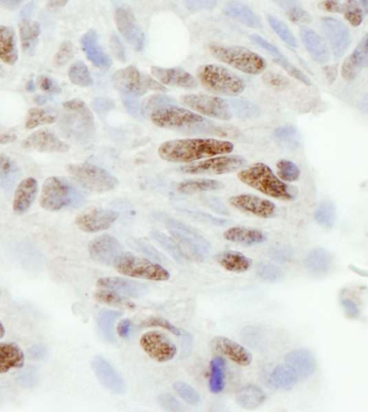 Polyclonal Rabbit anti-Human ZC3H11A Antibody (aa700-750, IHC)