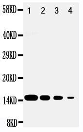 Polyclonal Rabbit anti-Human DDT / Dopamine Tautomerase Antibody (aa99-118, IHC, WB)
