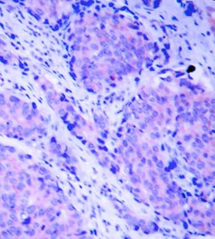 PDPK1 / PDK1 Antibody (phospho-Ser241)