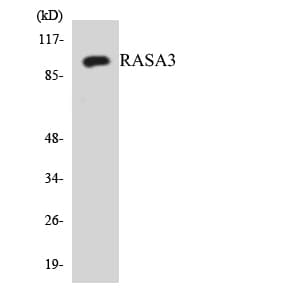 GAPIII / RASA3 Antibody (aa231-280)