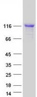 Human CAST / Calpastatin Protein (Recombinant Myc-DDK (Flag))
