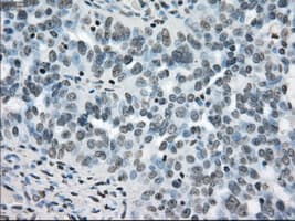 Monoclonal Mouse anti-Human BRAF / B-Raf Antibody (clone OTI4G6, IHC, WB)