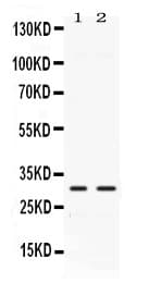 Polyclonal Rabbit anti-Human CA3 / Carbonic Anhydrase III Antibody (IHC, WB)