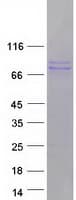 Human POSTN / Periostin Protein (Recombinant Myc-DDK (Flag))