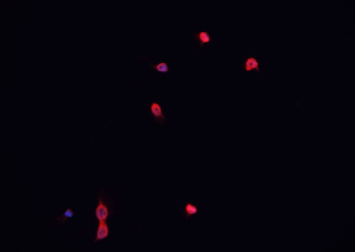 NBN / Nibrin Antibody (phospho-Ser278)