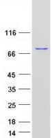 Human RDX / Radixin Protein (Recombinant Myc-DDK (Flag))