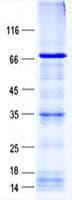 Human ZNF133 Protein (Recombinant His, N-Terminal)