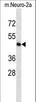 MAP2K5 / MEK5 Antibody (aa385-412)