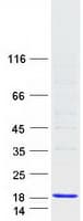 Human CYSTM1 / C5orf32 Protein (Recombinant Myc-DDK (Flag))
