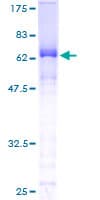 Human SLBP Protein (Recombinant GST)