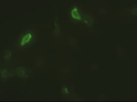 EPCAM Antibody (clone OTI2G1)